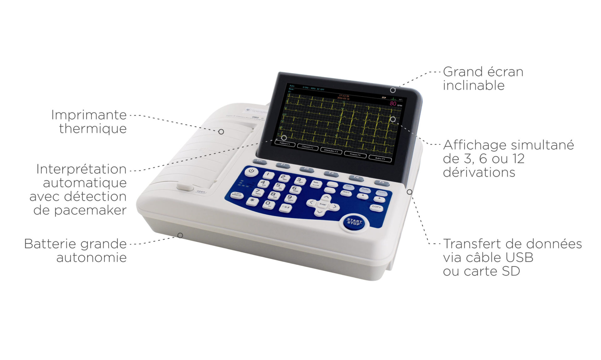 cardiomate ECG Spengler